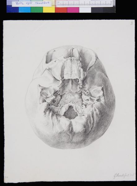 Gerard Sandifort, Skull, view from below