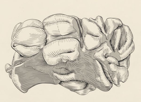 J Tinkelenberg, Part of the central nervous system of a lemur