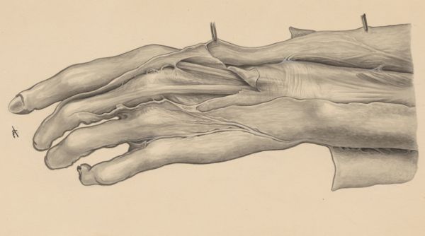 J Tinkelenberg, Muscular tissue of the hand