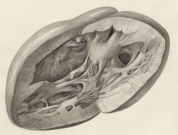 H.G Wetselaar, Heart
