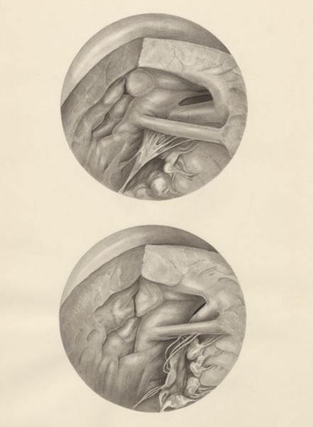 H.G Wetselaar, Two microscopic magnifications of parts of the heart