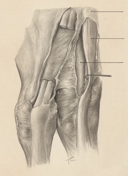 J Tinkelenberg, Musculoskeletal system of the upper extremity