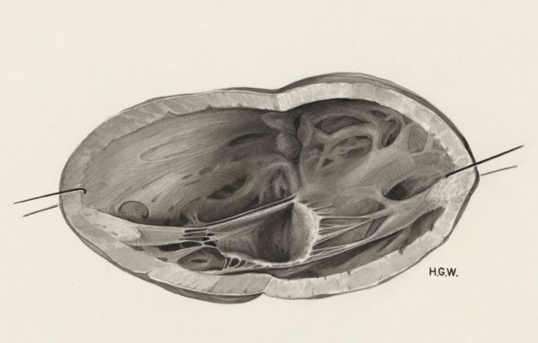 H.G Wetselaar, Cardiovascular system