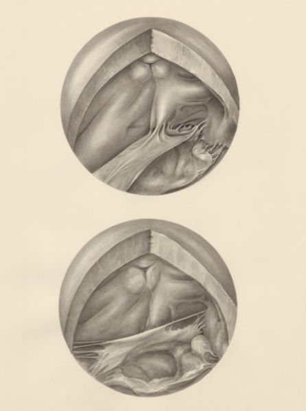 H.G Wetselaar, Two microscopic magnifications of parts of the heart