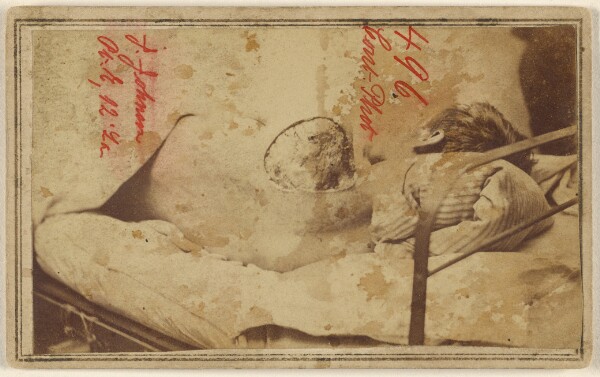 Unknown, [Joseph Johnson, Civil War victim]