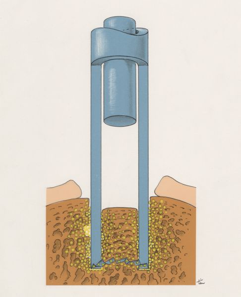 J Tinkelenberg, Bone drilling technique