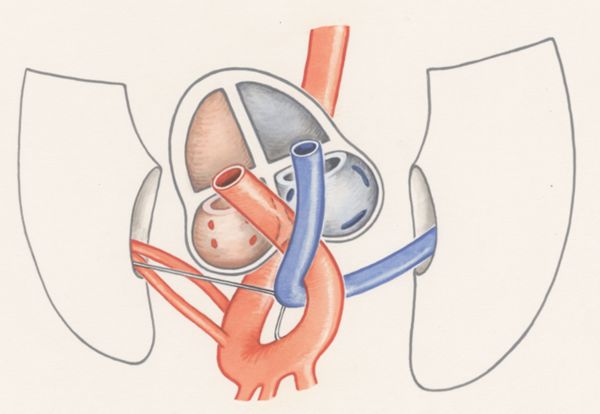 J Wetselaar-Whittaker, Arteries of the heart and adjacent organs