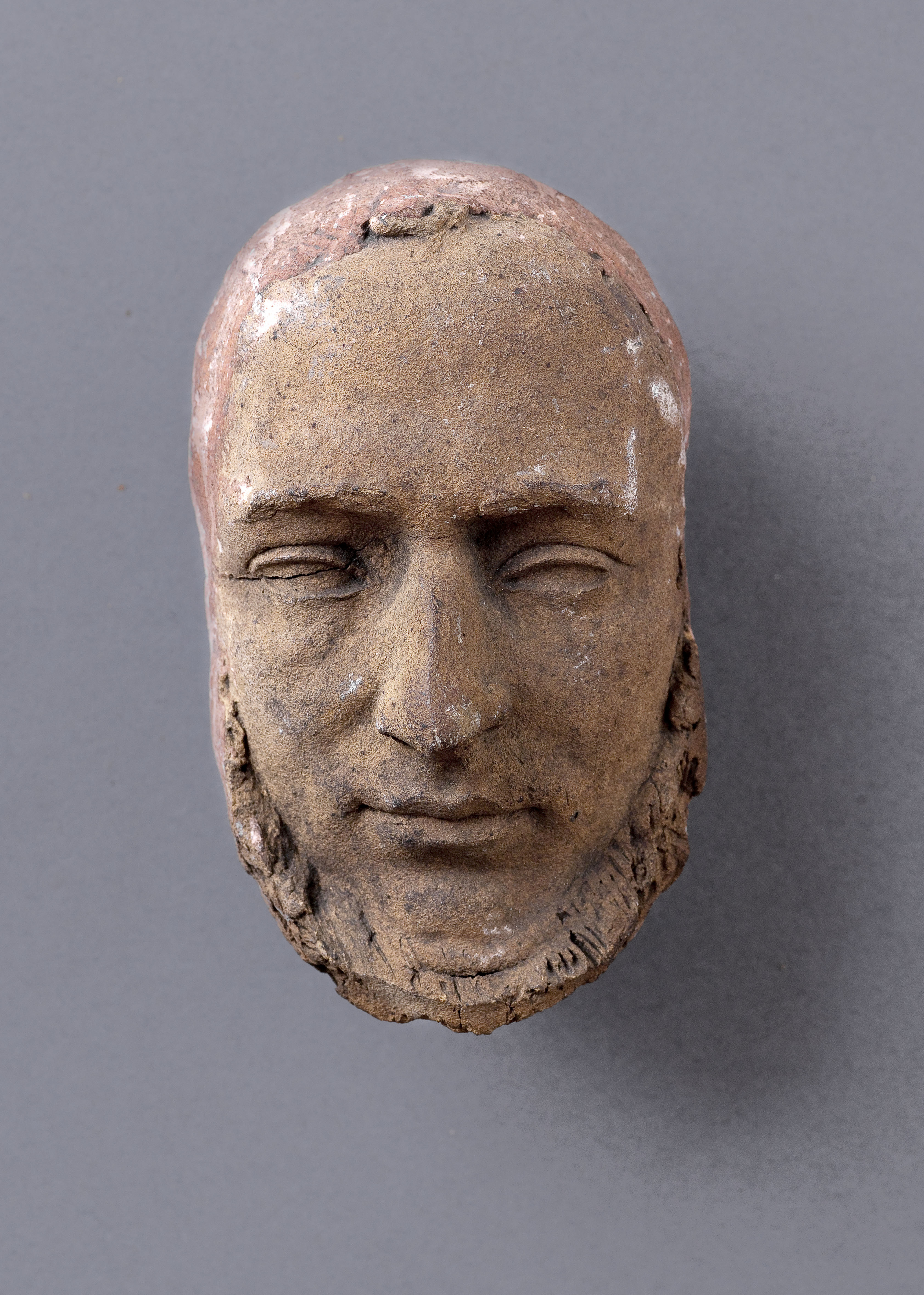 Jean Pierre Dantan, Portrait du chirurgien, Antoine Jobert, dit de Lamballe (1799-1867).