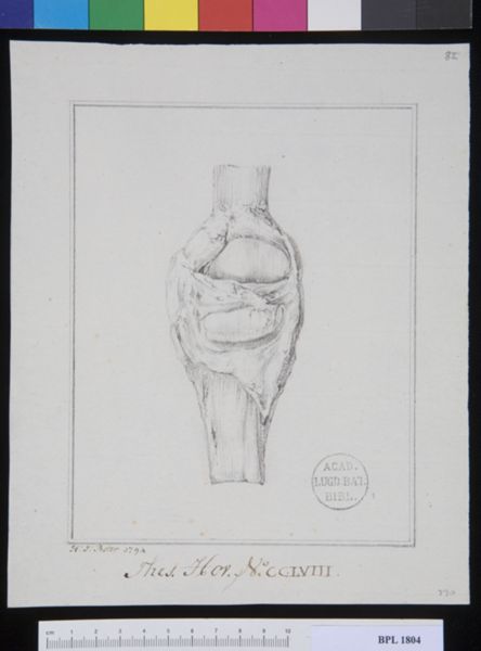 Poster, H.J, (active, Pathology, fractures (Patella)