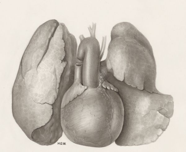 H.G Wetselaar, Heart and adjacent organs