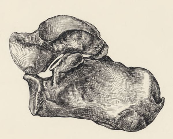 J Tinkelenberg, Musculoskeletal system of the lower extremity