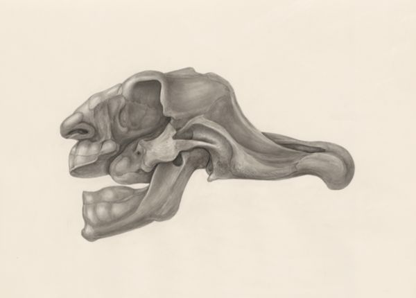 H.G Wetselaar, Deformed jawbone