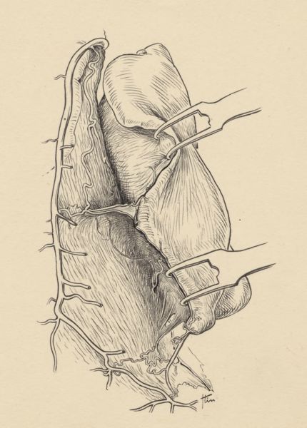 J Tinkelenberg, Part of the heart and circulatory system
