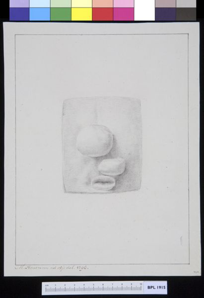 M Houtman, Inguinal herbia