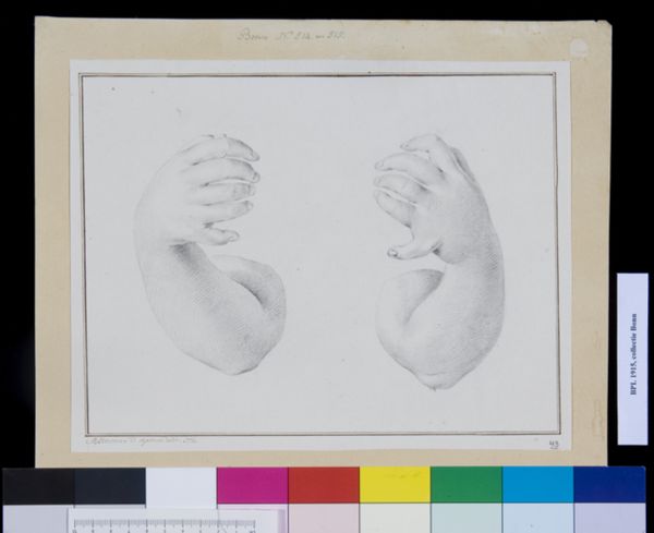 M. Houtman, Children's hands with five fingers and a thumb