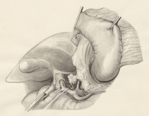J Wetselaar-Whittaker, Human tissue