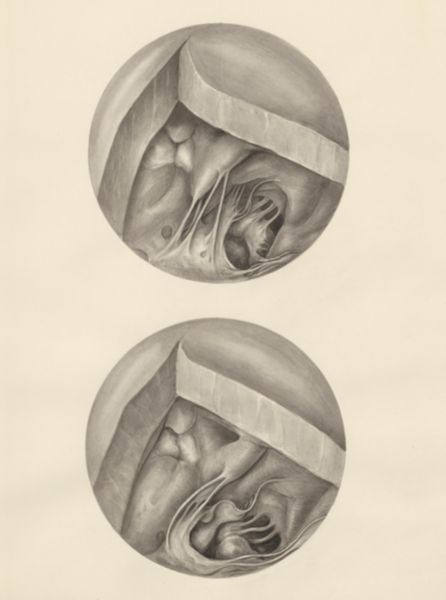 H.G Wetselaar, Two microscopic magnifications of parts of the heart