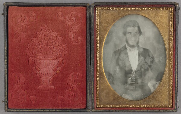 Unknown, [Portrait of a Seated Crossed-eyed Man]