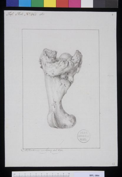 M. Houtman, Pathology, fractures (Femur)