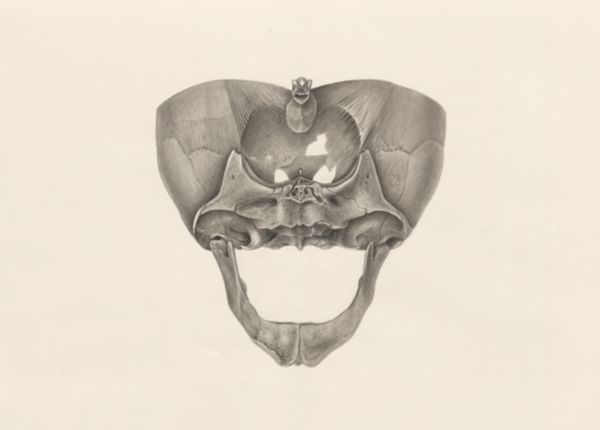 H.G Wetselaar, Deformed jawbone