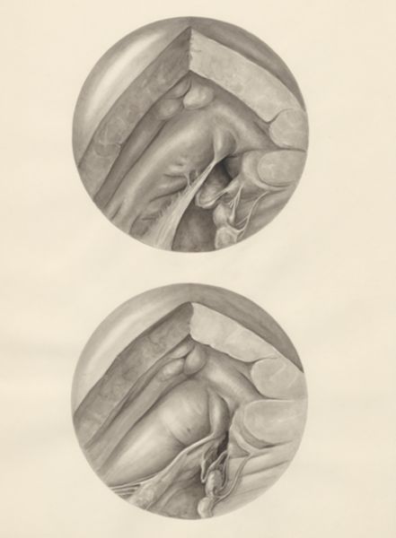 H.G Wetselaar, Two microscopic magnifications of parts of the heart
