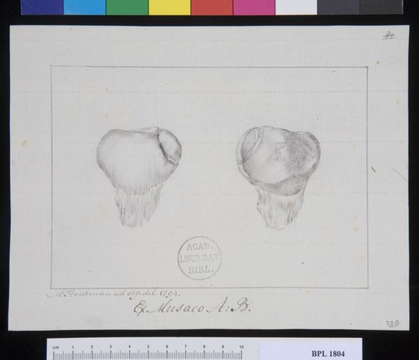 Poster, H.J, (active, Pathology, fractures (Patella)