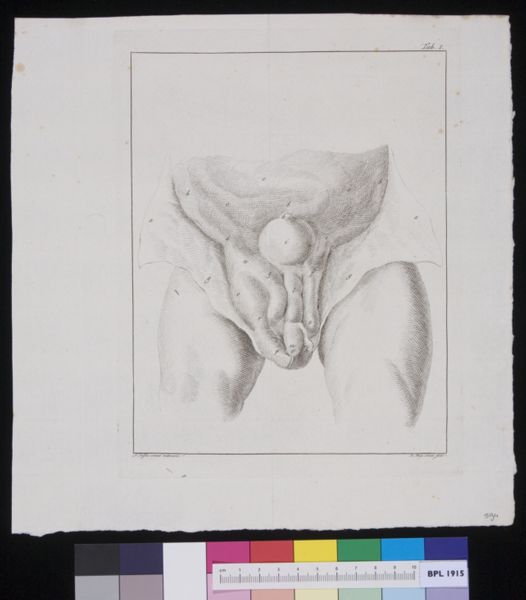 R Muys, Male urinary tract?