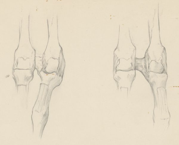 J Wetselaar-Whittaker, Two sets of finger joints