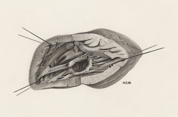 H.G Wetselaar, Cardiovascular system