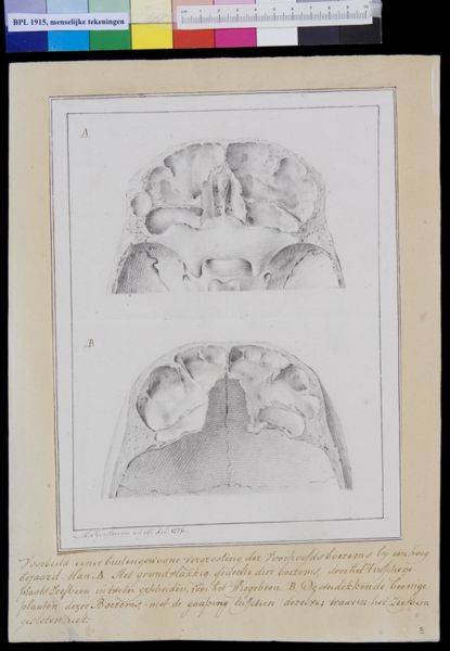 M Houtman, Skull