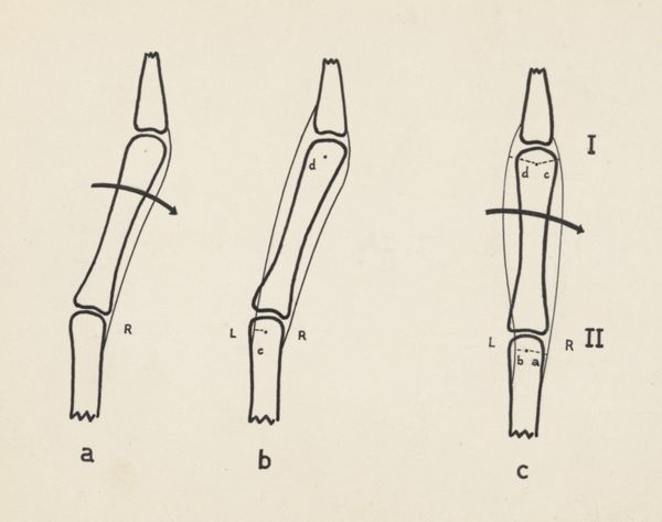 Harry de Bles, Schematic representation of the finger