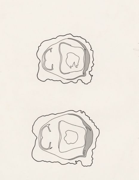 J Tinkelenberg, Schematic cross section of the fingers