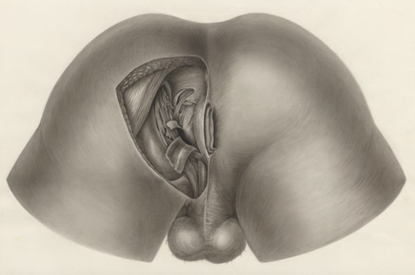 H.G Wetselaar, Tissue of the buttocks