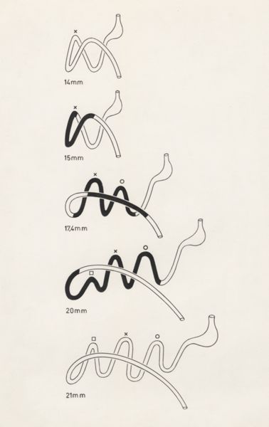 H.G Wetselaar, Schematic representation of the digestive system
