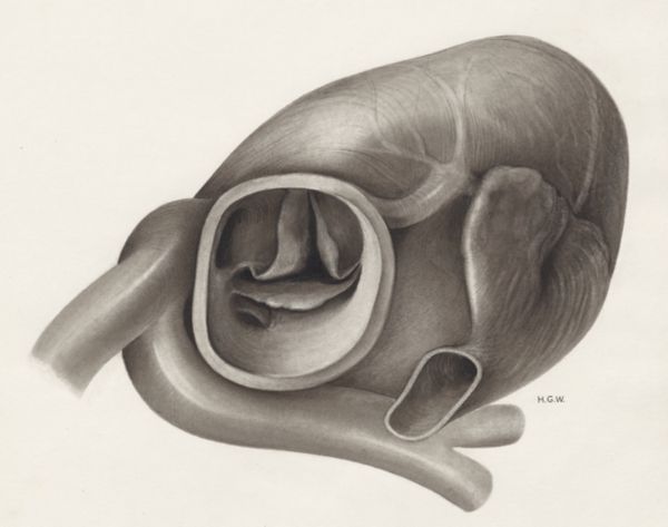 H.G Wetselaar, Heart and adjacent organs