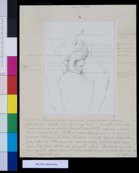 M. Houtman, Bladder