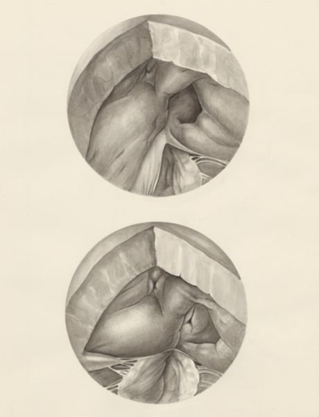 H.G Wetselaar, Two microscopic magnifications of parts of the heart