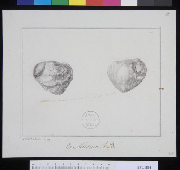 Poster, H.J, (active, Pathology, fractures (Patella)