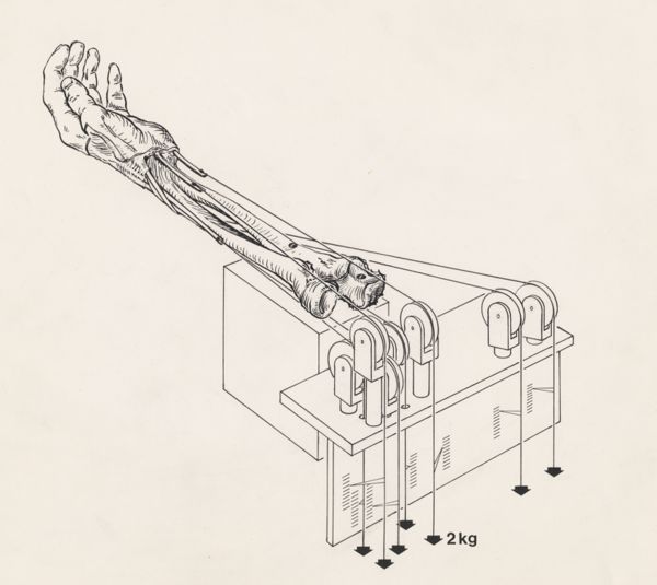 J Tinkelenberg, Musculoskeletal system of the hand, reconstructed by weights