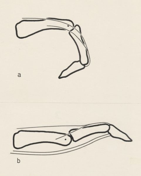 Harry de Bles, Schematic representation of the finger