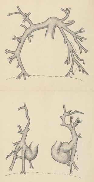 J Tinkelenberg, Circulatory system