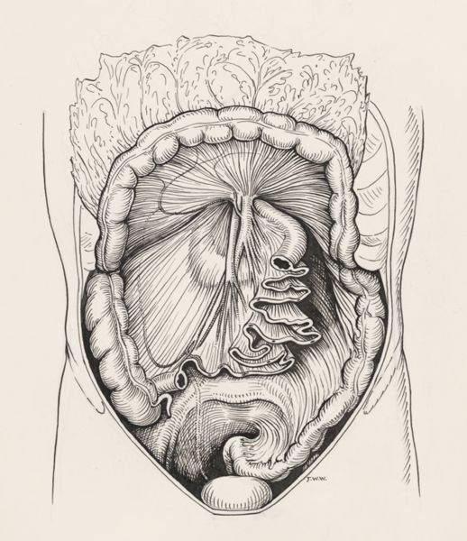 J Wetselaar-Whittaker, Intestinal tissue
