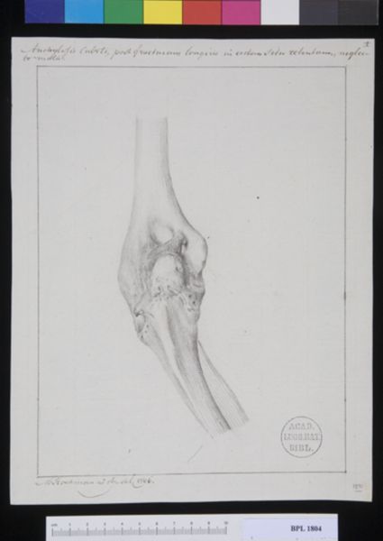 M. Houtman, Pathology, fractures (Ankylosis)