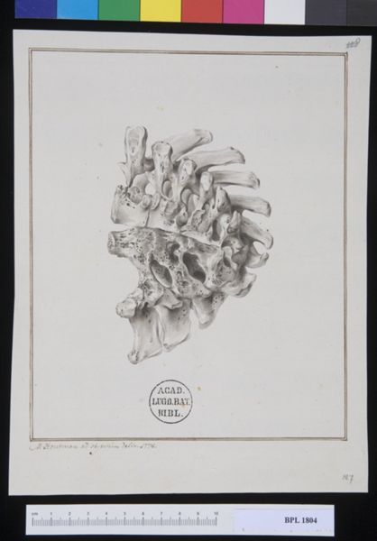 M Houtman, Pathology, fractures (Spine)