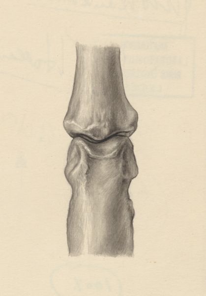 J Tinkelenberg, Joints of the hand or fingers