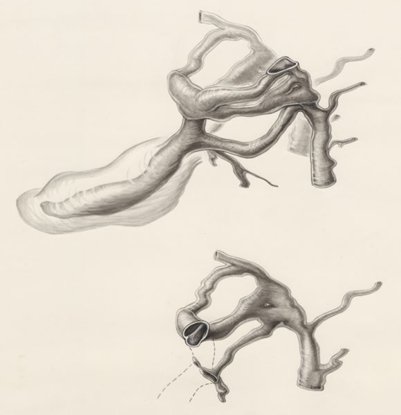 J Wetselaar-Whittaker, Tissue of a human embryo