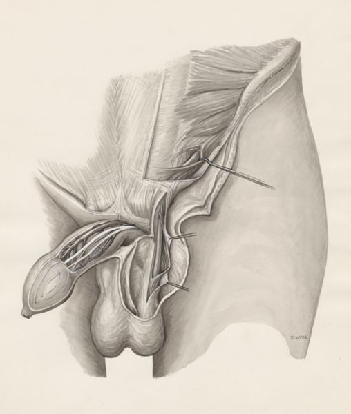 J Wetselaar-Whittaker, Male urogenital system