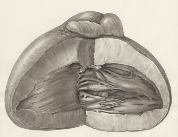 H.G Wetselaar, Heart