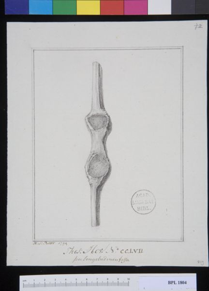 Poster, H.J, (active, Pathology, fractures (Patella)