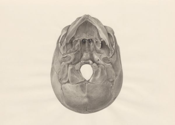 H.G Wetselaar, Deformed fetal skull, seen from below
